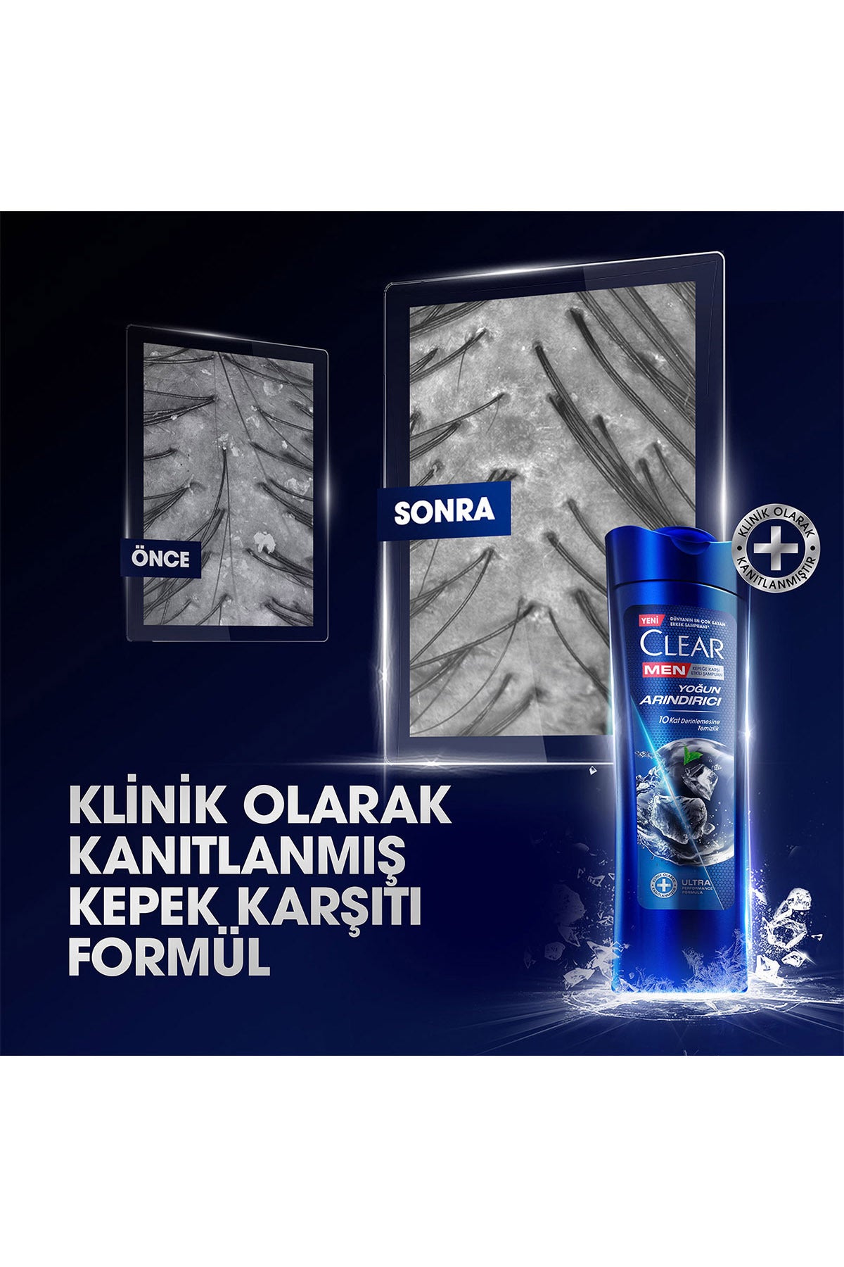 Men Kepeğe Karşı Etkili Şampuan Yoğun Arındırıcı 350 ml x3