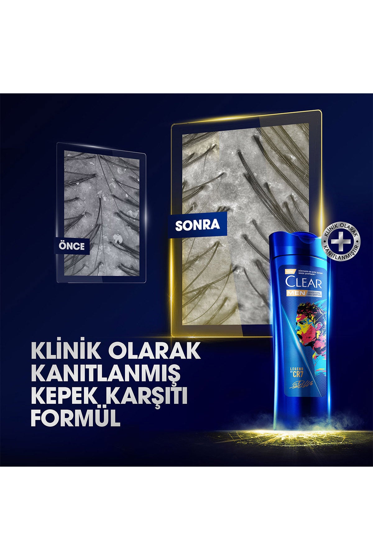 Men Kepeğe Karşı Etkili Şampuan Legend by CR7 350 ml x3