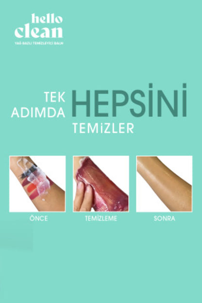 Hello Clean Gözenek Karşıtı Yağ Bazlı Temizleyici Balm Oleanolik Asit 100 ml X3